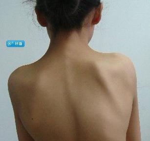 <em>12岁女孩</em>婷婷(化名)在
