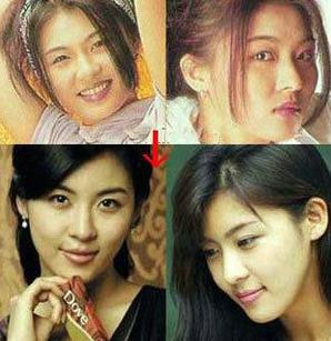 <em>朴艺珍整容前照片</em>